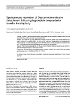 Spontaneous resolution of Descemet membrane detachment following big-bubble deep anterior lamellar keratoplasty